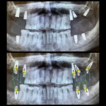 Fum. (FILEminimizer)