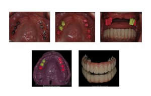Dott Cenzi (FILEminimizer)