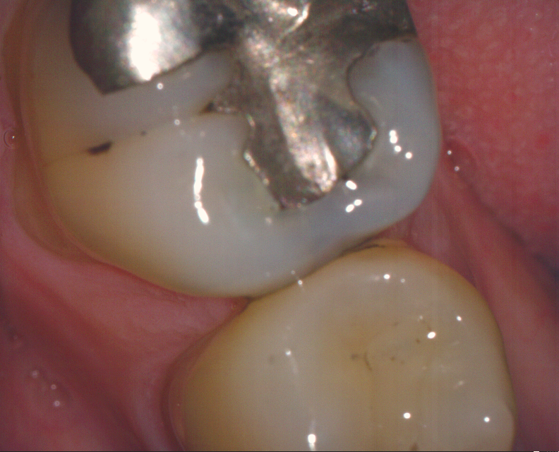 picture1