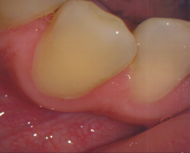 picture5